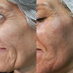 فیشال تخصصی و درمانی ونوس اسکینکر