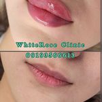کلینیک زیبایی رز سفید