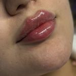 کلینیک زیبایی و لیزر لوتوس