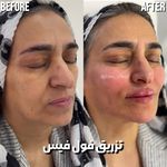 کلینیک زیبایی و لیزر هیرا