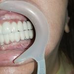 مطب ایمپلنت دکتر نیما شفیعی