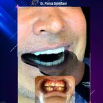 دندانپزشکی زیبایی دکتر پریسا دهقانی