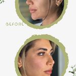 کلینیک لیزر  کندلاوزیبایی پوست ومو آیشیل