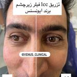 کلینیک پوست مو لیزر ونوس