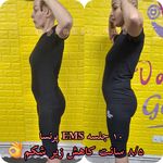 باشگاه لاغری EMS پرنسا(آقایان و بانوان)