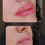 کلینیک پوست،مو، زیبایی و لیزر بارانا