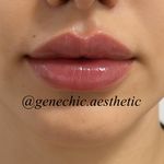 مطب پوست مو زیبایی و لاغری ژن شیک