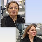 فیشال درمانی و پاکسازی پوست میرجلیلی