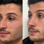 کلینیک زیبایی الماس کاملا اقساطی