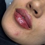 کلینیک زیبایی و جوانسازی پوست و مو الین