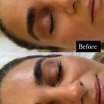 خدمات تخصصی پوست،فیشال،ماساژ سندی بانوان