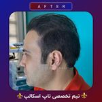 اولین مرکز میکرواسکالپ مشهد تاپ اسکالپ