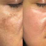 کلینیک زیبایی، فیشال امینی