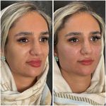 مجموعه لیزر و زیبایی کارنا(شاتی نداریم)