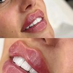 کلینیک ژل بوتاکس لیزر فیل بیوتی