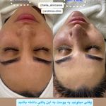 خدمات فیشیال و پاکسازی پوست