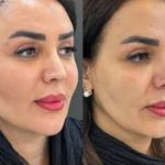 کلینیک زیبایی نامیرا