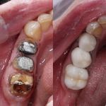 دنداپزشکی دکتر یاشار معزز