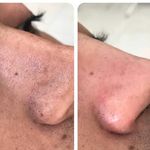 فشیال و پاکسازی تخصصی پوست