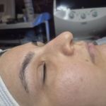 کلینیک فیشال و پاکسازی پوست نازی طلاکوب