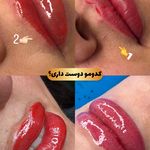 میکروکیماسی( میکروابرو چشم لب،ریمو)