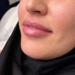کلینیک زیبایی پوستینو