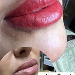 کلینیک لیزر و زیبایی مهسان