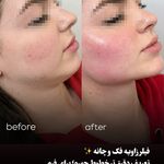 مرکز لیزر و کلینیک زیبایی پریفا