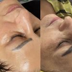 کلینیک تخصصی فیشال واسکراب اسکالپ مهرو