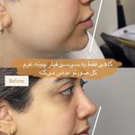 مرکز لیزر ،پوست و زیبایی کندی بیوتی
