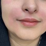 کلینیک زیبایی، پوست و لیزر(کندلا)  ظفر