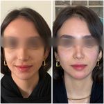 کلینیک زیبایی و لیزر دکتر آزاده اسماعیلی