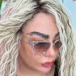 بافت مو شینا