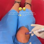 مرکز لیزر موهای زائد ماهور