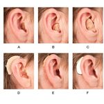 سمعک شنوا یزد