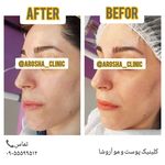 مرکز زیبایی,بوتاکس و لیزر آروشا