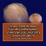 موسسه آموزش و درمان انواع ریزش مو ریشه