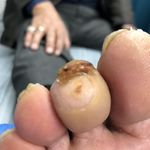 کلینیک درمان زخم و پودولوژی پودا