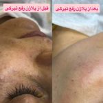 مرکز لیزر موهای زائد ماهور