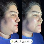 کلینیک زیبایی الماس کاملا اقساطی
