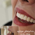 دندانپزشکی و دندانسازی مروارید