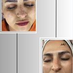 کلینیک فیشیال و پاکسازی پوست صبا