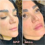 کلینیک زیبایی آفرینش،دکتر مهدی قهرمانیان