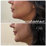 کلینیک زیبایی و لیزر مو زائد نوبا