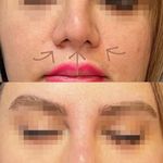 کلینیک ژل بوتاکس لیزر فیل بیوتی