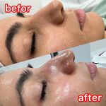خدمات تخصصی پوست (فیشیالیست رویا صالحی)