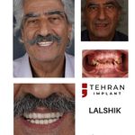 کلینیک تخصصی تهران ایمپلنت