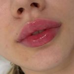 کلینیک زیبایی شایلی