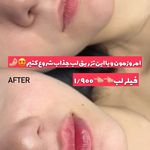 مرکز لیزر و کلینیک زیبایی پریفا