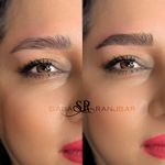 مرکز  میکروبلیدینگ  پی اس ام